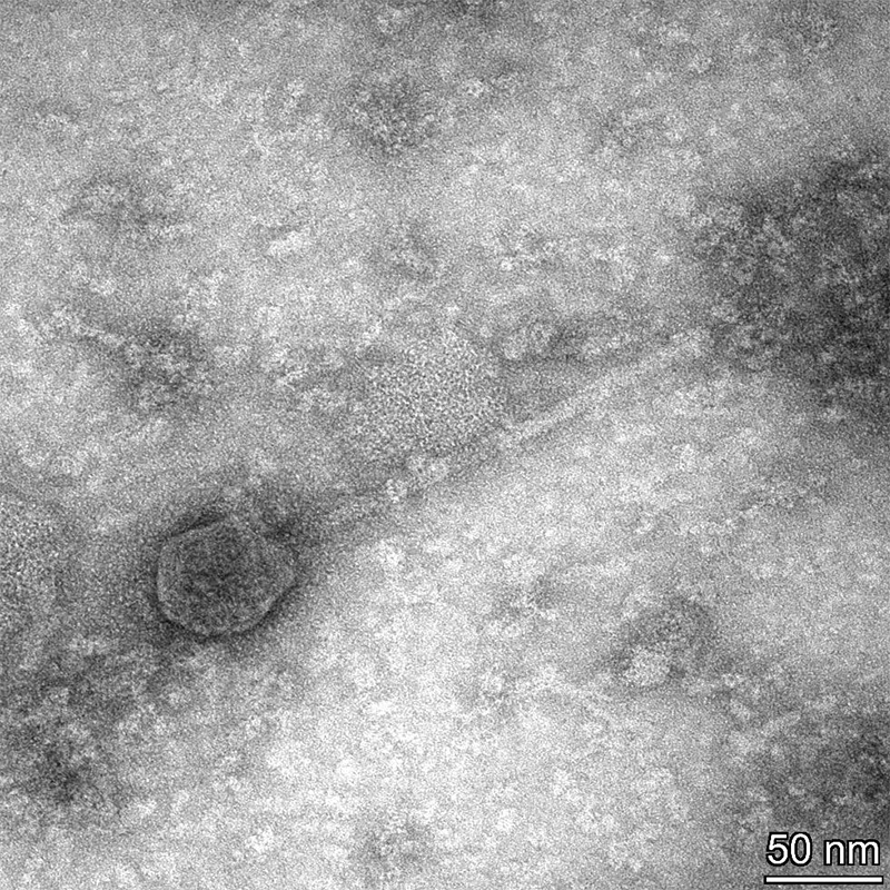 An image of Jant zoomed in to 50 nanometers. (Courtesy / Bill Ketola)